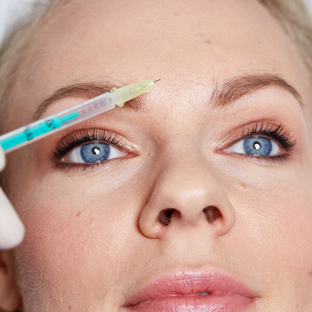 Botox Zornesfalte Linz. Effektive Behandlung Zornesfalte. Zornesfalte entfernen durch Botoxinjektion. Faltenkorrektur Zornesfalte, Botoxbehandlung Zornesfalte, Botox Linz Zornesfalte