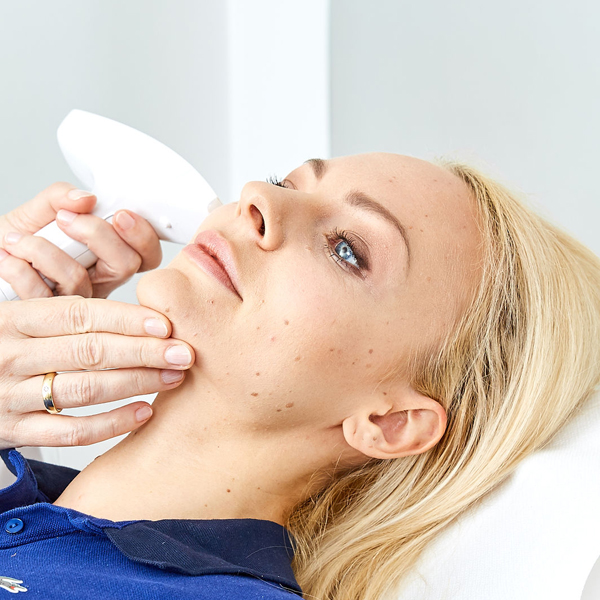 Couperose Laser Behandlung Linz, Couperose Behandlung Linz durch IPL Laser. Rosacea Gesicht Behandlung Linz, Gesichtsbehandlung Couperose Linz, Couperose Gesicht Therapie, Kupferfinne Behandlung, Couperose Behandlung Linz, Rosacea Nase Behandlung, Rosacea Therapie, Couperose lasern, rote Äderchen lasern, Kupferrose Therapie Linz