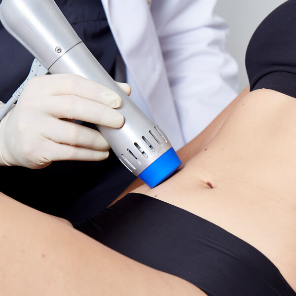 Dehnungsstreifen lasern Linz. Wachstumsstreifen weglasern bzw. korrigieren, Stoßwellen gegen Dehnungsstreifen, Stoßwellen Behandlung gegen Dehnungsstreifen