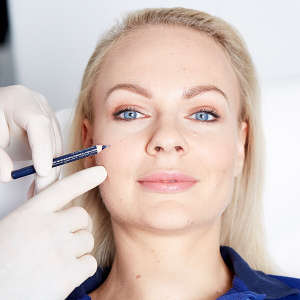 Hyaluron Unterspritzung Jochbogen in 4020 Linz. Hyaluron Wangen auffüllen, Faltenunterspritzung Jochbein, Jochbein unterspritzen Linz. Wangenaufpolstern mit Hyaluronsäure Linz