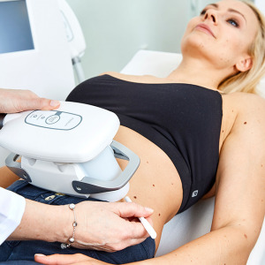 Kryolipolyse in Linz. Kryobehandlung Bauch, Fettabsaugung ohne Op. Kältebehandlung gegen Fett, Fettreduktion durch Kälte, Kryotherapie Bauchfett. Liposuction ohne Operation, Kryolipolyse Bauch