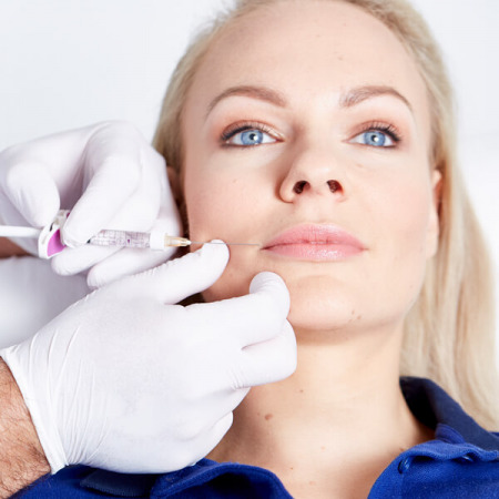 Lip Fillers in Linz. Lippenkorrektur in Linz mit Hyaluronsäure Lip Filler. Lip Fillers für ein jüngeres Aussehen, Lippen Volumen und Lippenkontur, Lippen Vergrößerung, Lippen aufspritzen. Lip Filler Behandlung Linz