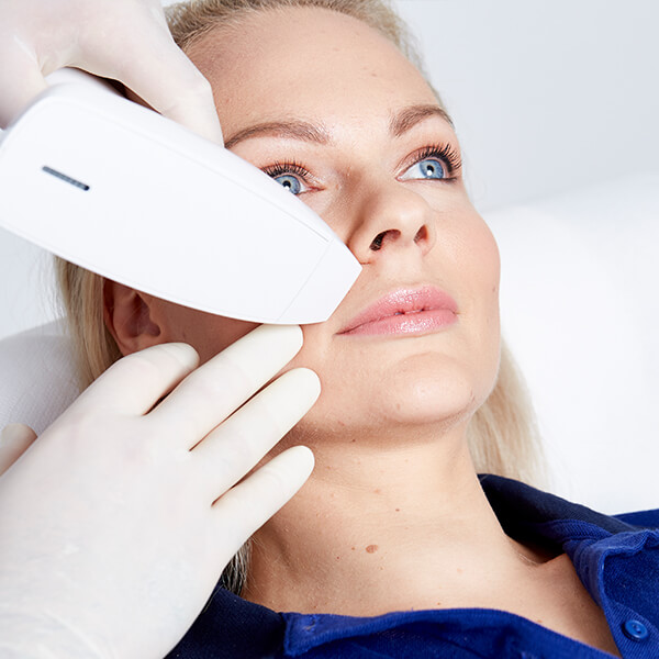 Lippenfalten lasern Linz, Lippenfalten entfernen, Falten um die Lippen entfernen, Lippen Falten weglasern, Lippenfalten entfernen in Linz. Mund Falten lasern