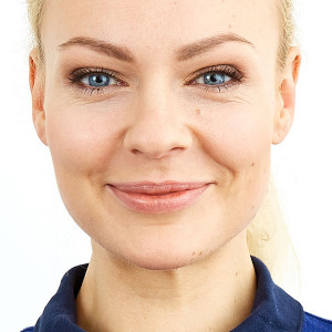 Oberlippenfalten unterspritzen, Oberlippen Faltenunterspritzung MED Zentrum 1, Oberlippenfältchen unterspritzen, Oberlippenfältchen entfernen, Faltenunterspritzung Oberlippe, Oberlippenfältchen behandeln, Plisseefalten Behandlung, Raucherfalten entfernen, periorale Falten Unterspritzung, Oberlippenfältchen glätten, Faltenunterspritzung Oberlippenfalten, Oberlippenfältchen Hyaluron, Faltenbehandlung Oberlippenfältchen