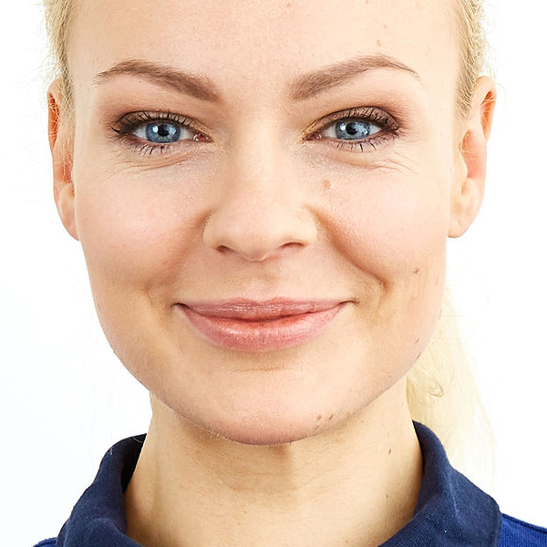 Oberlippenfalten unterspritzen, Oberlippen Faltenunterspritzung MED Zentrum 1, Oberlippenfältchen unterspritzen, Oberlippenfältchen entfernen, Faltenunterspritzung Oberlippe, Oberlippenfältchen behandeln, Plisseefalten Behandlung, Raucherfalten entfernen, periorale Falten Unterspritzung, Oberlippenfältchen glätten, Faltenunterspritzung Oberlippenfalten, Oberlippenfältchen Hyaluron, Faltenbehandlung Oberlippenfältchen